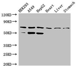 Invitrogen TCTN3 Polyclonal Antibody 100 &mu;g; Unconjugated:Antibodies,