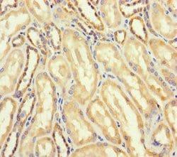 Invitrogen AspRS Polyclonal Antibody 100 &mu;g; Unconjugated:Antibodies,