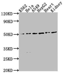 Invitrogen ENPP7 Polyclonal Antibody 100 &mu;L; Unconjugated:Antibodies,