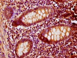 Invitrogen PNCK Polyclonal Antibody 100 &mu;g; Unconjugated:Antibodies,