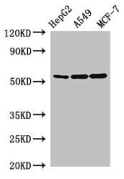 Invitrogen SLC24A5 Polyclonal Antibody 100 &mu;g; Unconjugated:Antibodies,