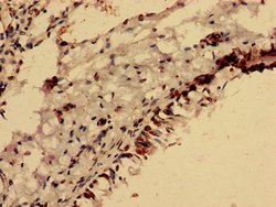 FOXR2 Polyclonal Antibody:Antibodies, Polyclonal