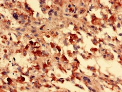 FOXR2 Polyclonal Antibody:Antibodies, Polyclonal