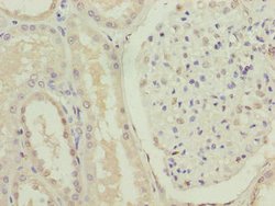 FOXR2 Polyclonal Antibody:Antibodies, Polyclonal