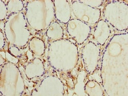FOXR2 Polyclonal Antibody:Antibodies, Polyclonal