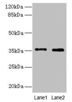 FOXR2 Polyclonal Antibody:Antibodies, Polyclonal