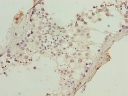 Invitrogen KRT80 Polyclonal Antibody 100 &mu;g; Unconjugated:Antibodies,