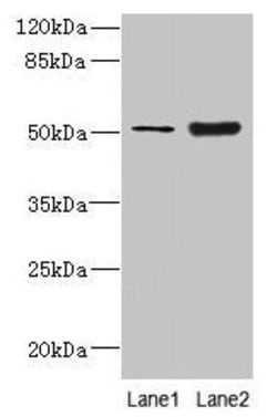 Invitrogen KRT80 Polyclonal Antibody 100 &mu;g; Unconjugated:Antibodies,