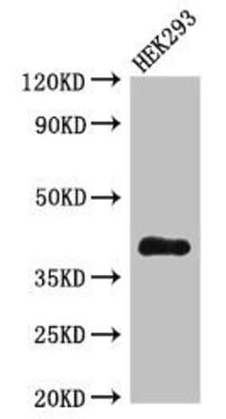 Invitrogen DHRS13 Polyclonal Antibody 100 &mu;g | Buy Online | Invitrogen&trade; | Fisher Scientific