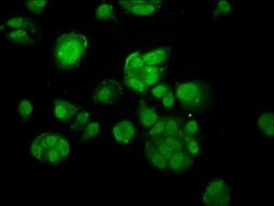 MACC1 Polyclonal Antibody:Antibodies, Polyclonal