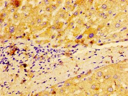 MACC1 Polyclonal Antibody:Antibodies, Polyclonal