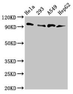 MACC1 Polyclonal Antibody:Antibodies, Polyclonal