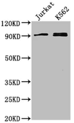 Invitrogen MARK2 Polyclonal Antibody 100 &mu;g; Unconjugated:Antibodies,