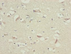 Invitrogen TTLL7 Polyclonal Antibody 100 &mu;L; Unconjugated:Antibodies,