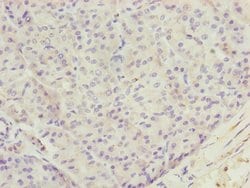 Invitrogen TTLL7 Polyclonal Antibody 100 &mu;L; Unconjugated:Antibodies,