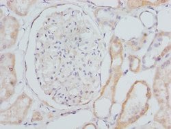 Invitrogen CYP4V2 Polyclonal Antibody 100 &mu;L; Unconjugated:Antibodies,