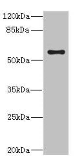 Invitrogen CYP4V2 Polyclonal Antibody 100 &mu;L; Unconjugated:Antibodies,