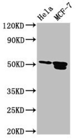 Invitrogen AP2 beta Polyclonal Antibody 100 &mu;g; Unconjugated:Antibodies,