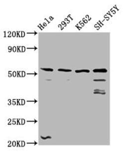 Invitrogen RIPX Polyclonal Antibody 100 &mu;g; Unconjugated:Antibodies,
