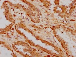 Invitrogen ILDR1 Polyclonal Antibody 100 &mu;L | Buy Online | Invitrogen&trade; | Fisher Scientific
