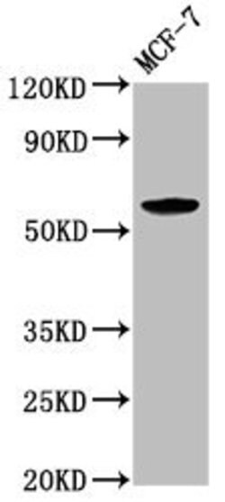 Invitrogen ILDR1 Polyclonal Antibody 100 &mu;L | Buy Online | Invitrogen&trade; | Fisher Scientific