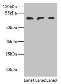 Invitrogen PLCZ1 Polyclonal Antibody 100 &mu;g | Buy Online | Invitrogen&trade; | Fisher Scientific