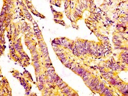 GDF7 Polyclonal Antibody:Antibodies, Polyclonal