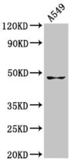 GDF7 Polyclonal Antibody:Antibodies, Polyclonal