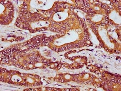 Invitrogen HOOK3 Polyclonal Antibody 100 &mu;g; Unconjugated:Antibodies,