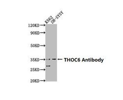 Invitrogen THOC6 Polyclonal Antibody 100 &mu;L; Unconjugated:Antibodies,