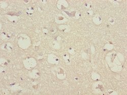 Invitrogen CEP57 Polyclonal Antibody 100 &mu;L | Buy Online | Invitrogen&trade; | Fisher Scientific