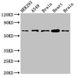 Invitrogen PXK Polyclonal Antibody 100 &mu;g; Unconjugated:Antibodies,