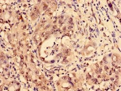 Invitrogen LDB1 Polyclonal Antibody 100 &mu;g; Unconjugated:Antibodies,