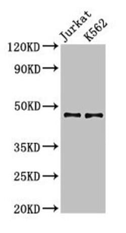 Invitrogen LDB1 Polyclonal Antibody 100 &mu;g; Unconjugated:Antibodies,