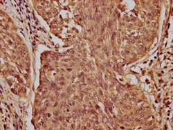 Invitrogen CASZ1 Polyclonal Antibody 100 &mu;g; Unconjugated:Antibodies,