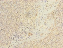 Invitrogen ARMC9 Polyclonal Antibody 100 &mu;g; Unconjugated:Antibodies,