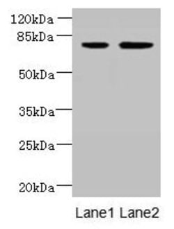 Invitrogen ARMC9 Polyclonal Antibody 100 &mu;g; Unconjugated:Antibodies,