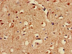 Invitrogen SPRED1 Polyclonal Antibody 100 &mu;g | Buy Online | Invitrogen&trade; | Fisher Scientific