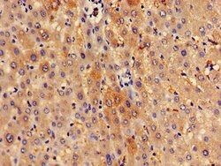 Invitrogen SPRED1 Polyclonal Antibody 100 &mu;g | Buy Online | Invitrogen&trade; | Fisher Scientific