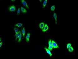 Invitrogen SLC46A3 Polyclonal Antibody 100 &mu;g; Unconjugated:Antibodies,