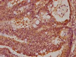 Invitrogen ARPIN Polyclonal Antibody 100 &mu;g; Unconjugated:Antibodies,