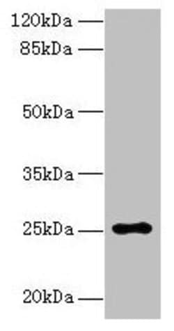 Invitrogen ARPIN Polyclonal Antibody 100 &mu;g; Unconjugated:Antibodies,