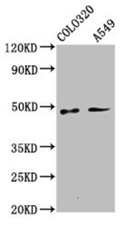 PNPLA5 Polyclonal Antibody 100 &mu;g | Buy Online | Invitrogen | Fisher Scientific
