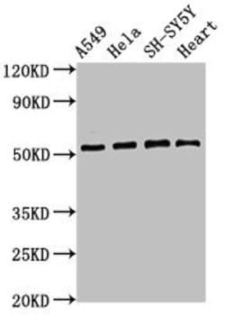 Invitrogen ATG4D Polyclonal Antibody 100 &mu;g; Unconjugated:Antibodies,