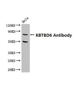 Invitrogen KBTBD6 Polyclonal Antibody 100 &mu;g | Buy Online | Invitrogen&trade; | Fisher Scientific