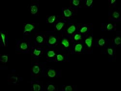 Invitrogen CAND1 Polyclonal Antibody 100 &mu;g; Unconjugated:Antibodies,