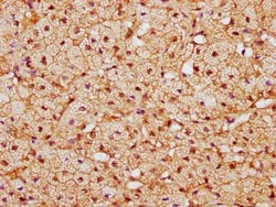 Invitrogen CAND1 Polyclonal Antibody 100 &mu;g; Unconjugated:Antibodies,