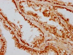 Invitrogen CAND1 Polyclonal Antibody 100 &mu;g; Unconjugated:Antibodies,