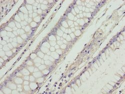 Invitrogen RD3 Polyclonal Antibody 100 &mu;g; Unconjugated:Antibodies,