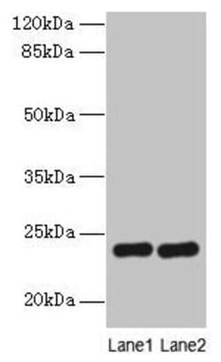Invitrogen RD3 Polyclonal Antibody 100 &mu;g; Unconjugated:Antibodies,